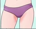 зуд.png